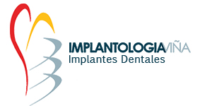 Implantologia Viña